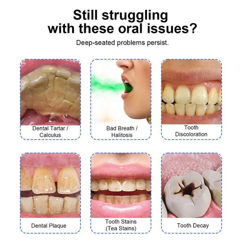 NBGRLVS Electric Scaler/Oral Plaque/Tartar Remover